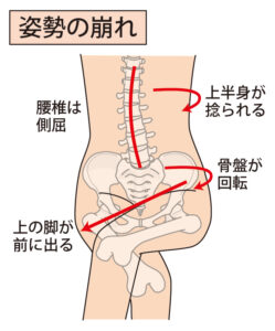 足を組むと体が左右どちらかに傾く